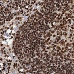 Invitrogen ZC3H18 Polyclonal Antibody 100 &mu;L; Unconjugated:Antibodies,