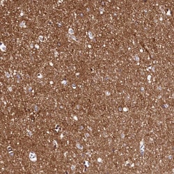 Invitrogen FXYD6 Polyclonal Antibody 100 &mu;L; Unconjugated:Antibodies,