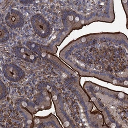 Invitrogen C10orf47 Polyclonal Antibody 100 &mu;L; Unconjugated:Antibodies,