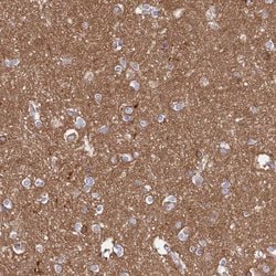 Invitrogen TMOD2 Polyclonal Antibody 100 &mu;L; Unconjugated:Antibodies,
