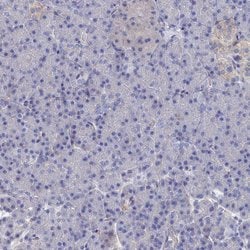 Invitrogen TMOD2 Polyclonal Antibody 100 &mu;L; Unconjugated:Antibodies,