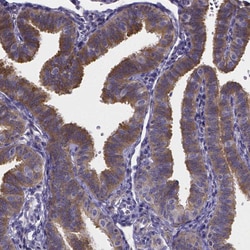 Invitrogen RERG Polyclonal Antibody 100 &mu;L; Unconjugated:Antibodies,