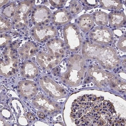 Invitrogen RERG Polyclonal Antibody 100 &mu;L; Unconjugated:Antibodies,
