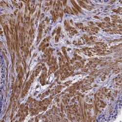 Invitrogen RERG Polyclonal Antibody 100 &mu;L; Unconjugated:Antibodies,