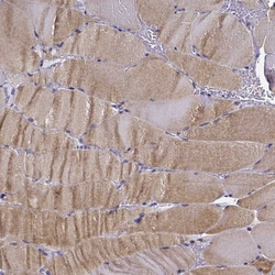 Invitrogen RERG Polyclonal Antibody 100 &mu;L; Unconjugated:Antibodies,