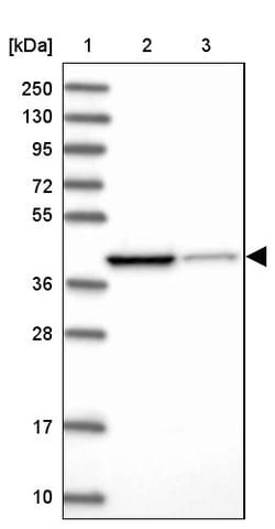 Invitrogen IVD Polyclonal Antibody 100 &mu;L; Unconjugated:Anticuerpos