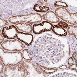 Invitrogen ATP Synthase O Polyclonal Antibody 100 &mu;L; Unconjugated:Antikörper