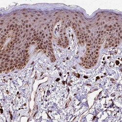 Invitrogen CDKN2AIP Polyclonal Antibody 100 &mu;L; Unconjugated:Antibodies,