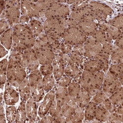 Invitrogen CDKN2AIP Polyclonal Antibody 100 &mu;L; Unconjugated:Antibodies,