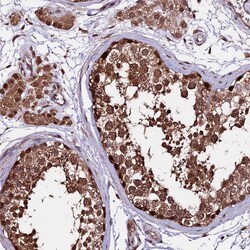 Invitrogen CDKN2AIP Polyclonal Antibody 100 &mu;L; Unconjugated:Antibodies,