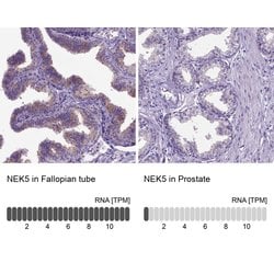 Invitrogen NEK5 Polyclonal Antibody 100 &mu;L; Unconjugated:Antibodies,