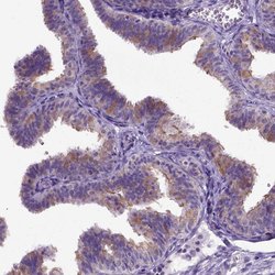 Invitrogen NEK5 Polyclonal Antibody 100 &mu;L; Unconjugated:Antibodies,