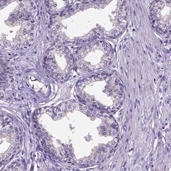 Invitrogen NEK5 Polyclonal Antibody 100 &mu;L; Unconjugated:Antibodies,