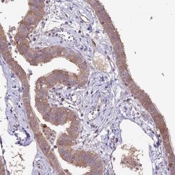 Invitrogen COG8 Polyclonal Antibody 100 &mu;L; Unconjugated:Antibodies,