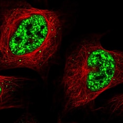 Invitrogen SRRM2 Polyclonal Antibody 100 &mu;L; Unconjugated:Antibodies,
