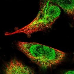 Invitrogen SPIRE2 Polyclonal Antibody 100 &mu;L | Buy Online | Invitrogen&trade; | Fisher Scientific