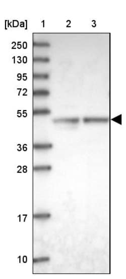 Invitrogen ARMC6 Polyclonal Antibody 100 &mu;L | Buy Online | Invitrogen&trade; | Fisher Scientific