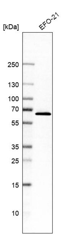 Invitrogen C14orf159 Polyclonal Antibody 100 &mu;L | Buy Online | Invitrogen&trade; | Fisher Scientific