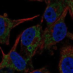 CMPK2 Rabbit anti-Human, Polyclonal, Invitrogen 100 &mu;L; Unconjugated:Antibodies,