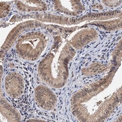 CMPK2 Rabbit anti-Human, Polyclonal, Invitrogen 100 &mu;L; Unconjugated:Antibodies,