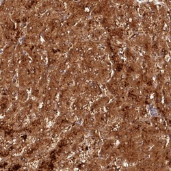 Invitrogen ACSM5 Polyclonal Antibody 100 &mu;L; Unconjugated:Antibodies,