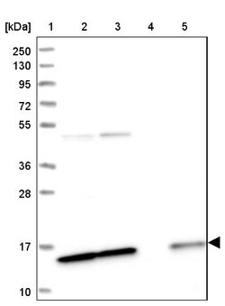 Invitrogen SNRPD2 Polyclonal Antibody 100 &mu;L | Buy Online | Invitrogen&trade; | Fisher Scientific