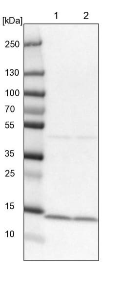 Invitrogen SNRPD2 Polyclonal Antibody 100 &mu;L | Buy Online | Invitrogen&trade; | Fisher Scientific