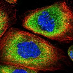 Invitrogen SNRPD2 Polyclonal Antibody 100 &mu;L; Unconjugated:Antibodies,