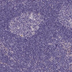 Invitrogen PLEKHG6 Polyclonal Antibody 100 &mu;L; Unconjugated:Antibodies,