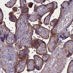 Invitrogen PLEKHG6 Polyclonal Antibody 100 &mu;L; Unconjugated:Antibodies,
