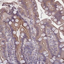 Invitrogen PLEKHG6 Polyclonal Antibody 100 &mu;L; Unconjugated:Antibodies,