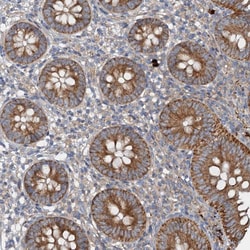 Invitrogen ANKRD26 Polyclonal Antibody 100 &mu;L; Unconjugated:Antibodies,