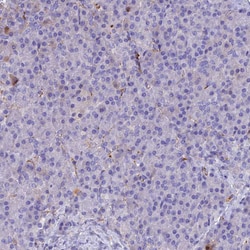Invitrogen PZP Polyclonal Antibody 100 &mu;L; Unconjugated:Antibodies,