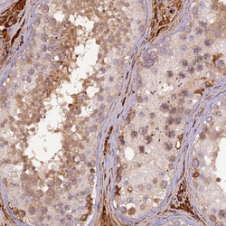 Invitrogen PZP Polyclonal Antibody 100 &mu;L; Unconjugated:Antibodies,