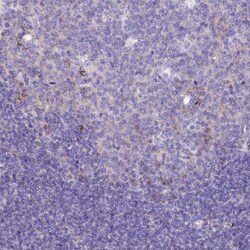 Invitrogen PZP Polyclonal Antibody 100 &mu;L; Unconjugated:Antibodies,