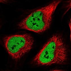 Invitrogen POLR3E Polyclonal Antibody 100 &mu;L; Unconjugated:Antibodies,