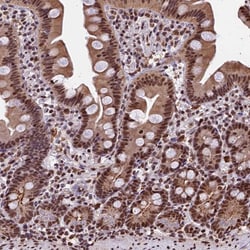 Invitrogen POLR3E Polyclonal Antibody 100 &mu;L; Unconjugated:Antibodies,