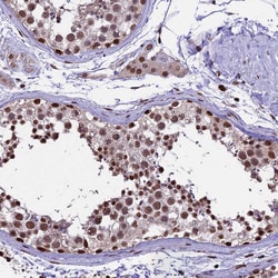 Invitrogen POLR3E Polyclonal Antibody 100 &mu;L; Unconjugated:Antibodies,