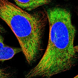 Invitrogen PPP1R37 Polyclonal Antibody 100 &mu;L; Unconjugated:Antibodies,