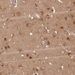 Invitrogen PPP1R37 Polyclonal Antibody 100 &mu;L; Unconjugated:Antibodies,