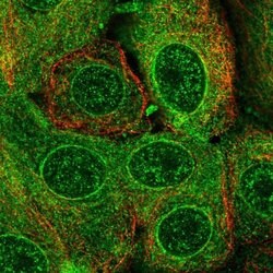 Invitrogen TMEM205 Polyclonal Antibody 100 &mu;L; Unconjugated:Antibodies,