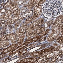 Invitrogen TMEM205 Polyclonal Antibody 100 &mu;L; Unconjugated:Antibodies,