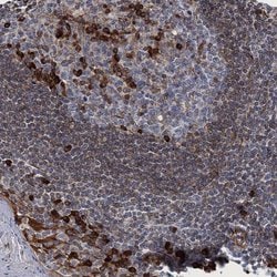 Invitrogen TMEM205 Polyclonal Antibody 100 &mu;L; Unconjugated:Antibodies,