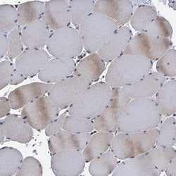 Invitrogen TMEM205 Polyclonal Antibody 100 &mu;L; Unconjugated:Antibodies,