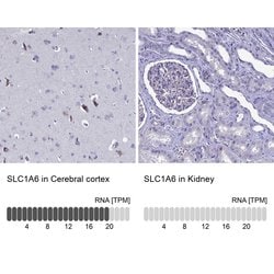 Invitrogen SLC1A6 Polyclonal Antibody 100 &mu;L; Unconjugated:Antibodies,