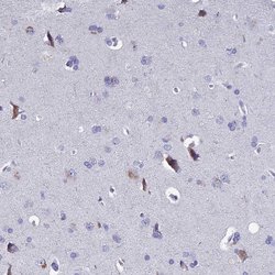 Invitrogen SLC1A6 Polyclonal Antibody 100 &mu;L; Unconjugated:Antibodies,