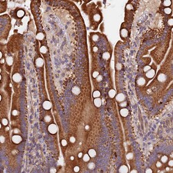 Invitrogen ATXN2L Polyclonal Antibody 100 &mu;L; Unconjugated:Antibodies,