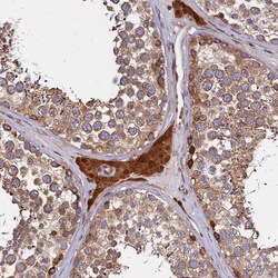 Invitrogen ATXN2L Polyclonal Antibody 100 &mu;L; Unconjugated:Antibodies,