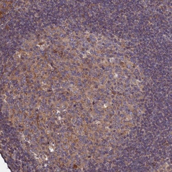 Invitrogen ATXN2L Polyclonal Antibody 100 &mu;L; Unconjugated:Antibodies,