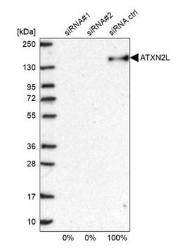 Invitrogen ATXN2L Polyclonal Antibody 100 &mu;L; Unconjugated:Antibodies,